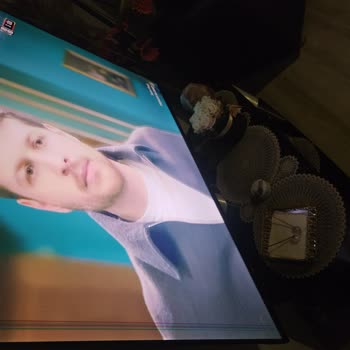 A101 Televizyonunda Ekran Çizgileri Ve Servis Yanıtsızlığı