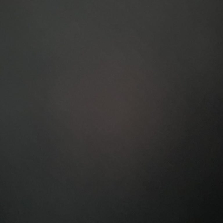 Yetkisiz 1 Milyon TL İşlem Ve Acil Müşteri Hizmeti Bağlantısı Sorunu