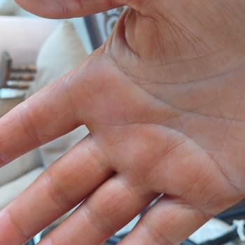 Tatilde Kullandığım Sun Ozon Bronzluk Serumu Cildimde Koyu Kahverengi Lekeler Bıraktı