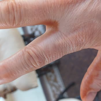 Tatilde Kullandığım Sun Ozon Bronzluk Serumu Cildimde Koyu Kahverengi Lekeler Bıraktı