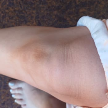 Tatilde Kullandığım Sun Ozon Bronzluk Serumu Cildimde Koyu Kahverengi Lekeler Bıraktı