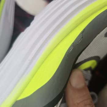 Slazenger Ayakkabıda İlk Kullanımda Deri Soyulması Ve Değişim Talebi