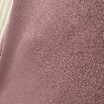 Erzurum MNG AVM Chima Mağazasından Alınan Elbisenin Tek Kullanımda Tüylenmesi