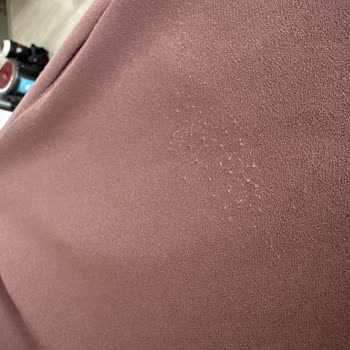 Erzurum MNG AVM Chima Mağazasından Alınan Elbisenin Tek Kullanımda Tüylenmesi