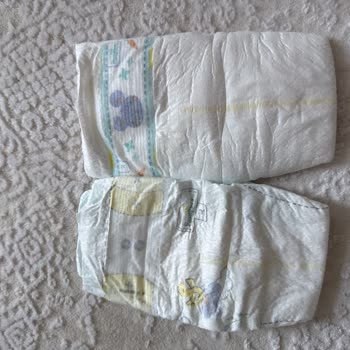 Yanlış Bez Teslimatı Bebek Sağlığına Risk Oluşturuyor