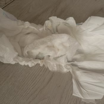 Molfix Moms 5 Nolu Bebek Bezinde Yırtık Ve Tomurcuk Sorunu