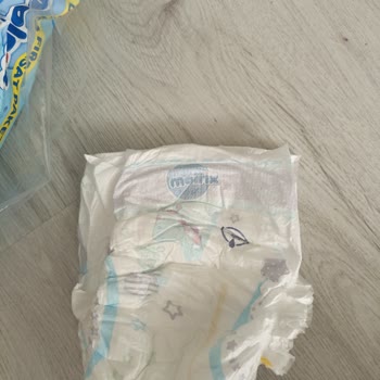 Molfix Moms 5 Nolu Bebek Bezinde Yırtık Ve Tomurcuk Sorunu