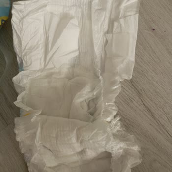 Molfix Moms 5 Nolu Bebek Bezinde Yırtık Ve Tomurcuk Sorunu