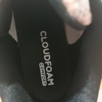 Ayıplı Adidas Ayakkabısının Değişim Talebi Ve Mağaza Reddi