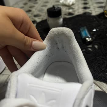Adidas Superstar Ayakkabısında Erken Tüylenme Ve İade Talebi