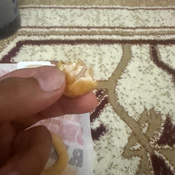 Kemik Parçası İçeren Nugget Nedeniyle Diş Kırıldı Ve Sağlık Mağduru Oldum