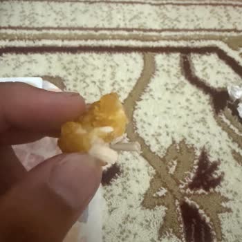 Kemik Parçası İçeren Nugget Nedeniyle Diş Kırıldı Ve Sağlık Mağduru Oldum