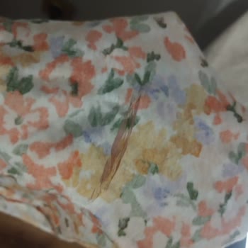 Kumaş Açılmaları Ve İade Reddi Nedeniyle Para İadesi Talebi