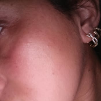Wiwify Yüz Ürünleri Cildimi Tahriş Etti, İade Talebi
