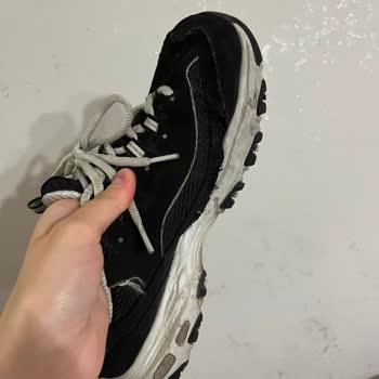 Garanti İçindeki Skechers Ayakkabıda Taban Açılması Ve Değişim Talebinin Reddedilmesi