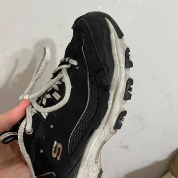 Garanti İçindeki Skechers Ayakkabıda Taban Açılması Ve Değişim Talebinin Reddedilmesi