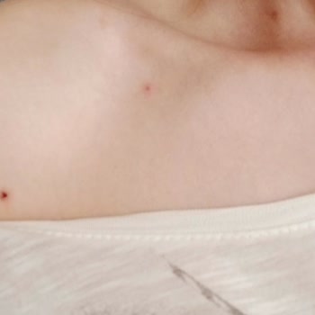 Cilt Sorunuma Sadece Psikiyatrik Yönlendirme, Kök Neden Araştırılmadı