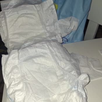 Sağ Taraf Bantlarının Kopması Nedeniyle Molfix Mega Bebek Bezlerinde Kullanım Problemi