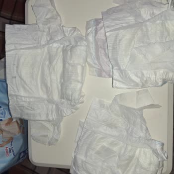 Sağ Taraf Bantlarının Kopması Nedeniyle Molfix Mega Bebek Bezlerinde Kullanım Problemi