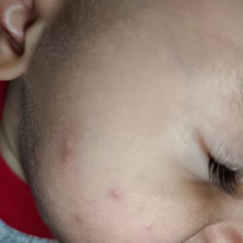 Uncubozköy'de Sivrisinek Sorunu Bebeğimizi Uyutamıyor
