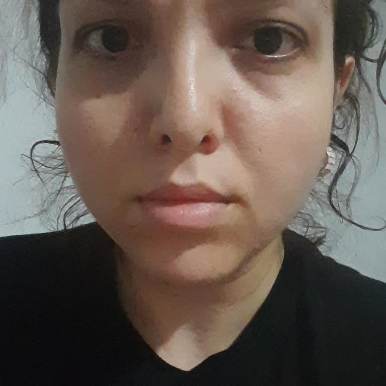 Eski BİP Hesabına Yeni Numara Üzerinden Erişim Talebi