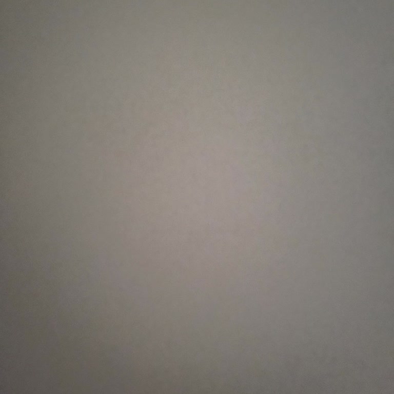 ATM 40.000 TL Paramı Yutması Ve Hesaba Yansımaması