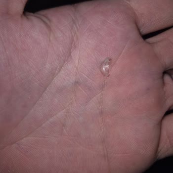 Arı Mama Kaşık Mamasında Mikaya Benzer Sert Parça Çıktı, Bebek Boğulma Korkusu
