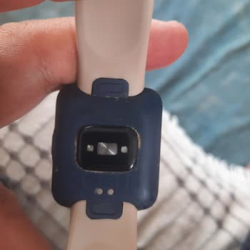 Xiaomi Watch 2 Pro Saatinin Aşırı Isınması Bileği Yaktı