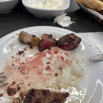 Hijyen Ve Çiğ Köfte Sorunu Nedeniyle Ücret İadesi Talebi
