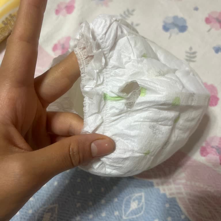 Sleepy Külot Bezinde Yırtık Ve Sızıntı Nedeniyle Ücret İadesi Talebi