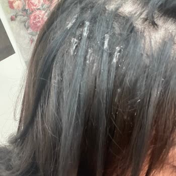 Keratin Saç Tedavisi Eridi; Saçlar Çöp Oldu Ve Geri Dönüş Yok; İade Talebi