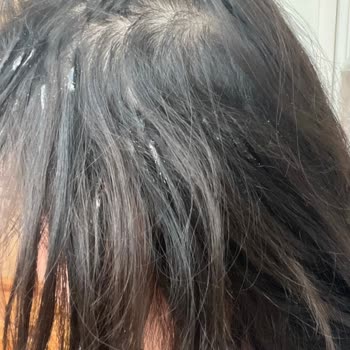 Keratin Saç Tedavisi Eridi; Saçlar Çöp Oldu Ve Geri Dönüş Yok; İade Talebi