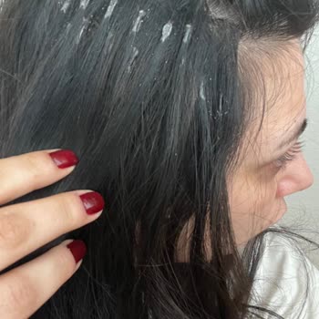 Keratin Saç Tedavisi Eridi; Saçlar Çöp Oldu Ve Geri Dönüş Yok; İade Talebi