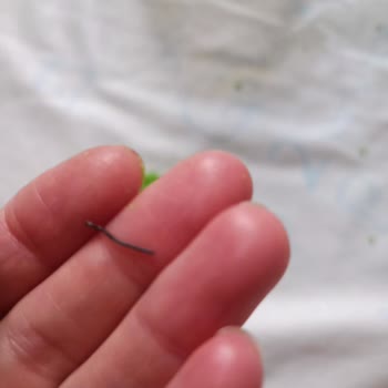 Çocuğuma Küflü Metal Parça Çıktı; Şirket Cevapsız Kaldı