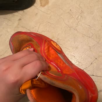 Altı Ay On Gün Sonra Garanti Reddi Ve Aşırı Aşınan Ayakkabı