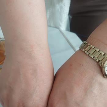 Magnum Dondurmasında Küflü Ürün Ve Ciddi Alerjik Reaksiyon