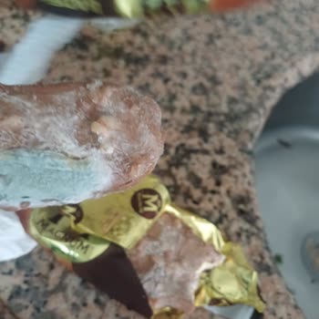 Magnum Dondurmasında Küflü Ürün Ve Ciddi Alerjik Reaksiyon