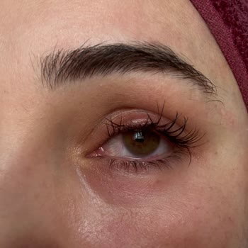 Sema Konak Güzellik Ve Lazer Epilasyon Merkezi Son Derece Olumsuz Bir Deneyim Yaşadım