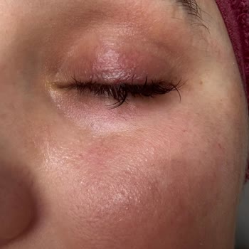 Sema Konak Güzellik Ve Lazer Epilasyon Merkezi Son Derece Olumsuz Bir Deneyim Yaşadım