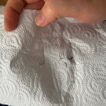 Sema Konak Güzellik Ve Lazer Epilasyon Merkezi Son Derece Olumsuz Bir Deneyim Yaşadım