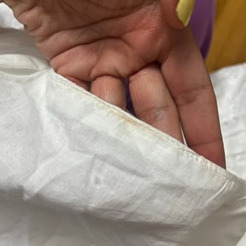 Teslimat Gecikmesi Ve Lekeli Ürün Şikayeti