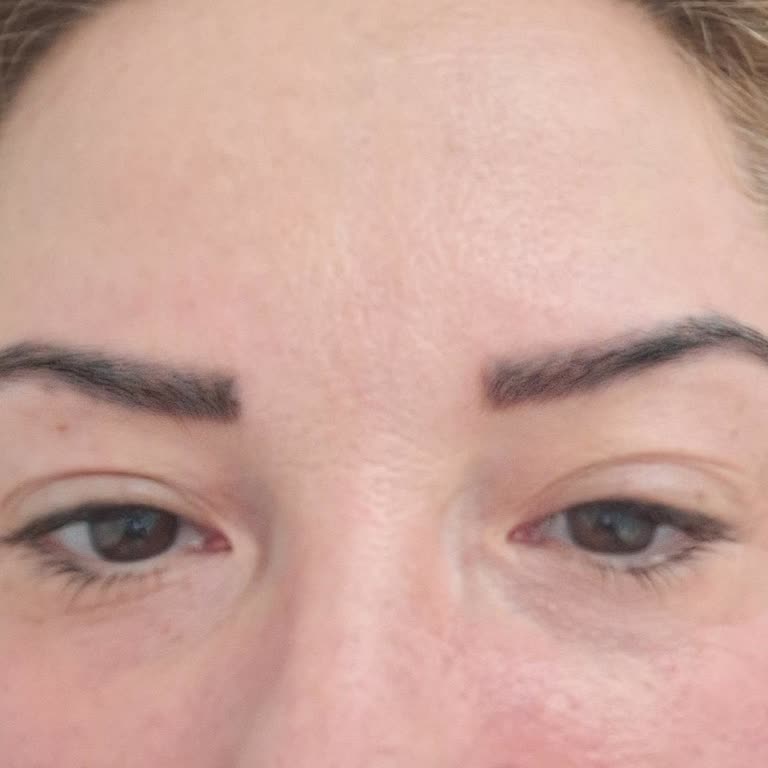 Kaş Microblading İşlemi Etkisini Kaybetti, İade Ve Yeniden İşlem Talebi