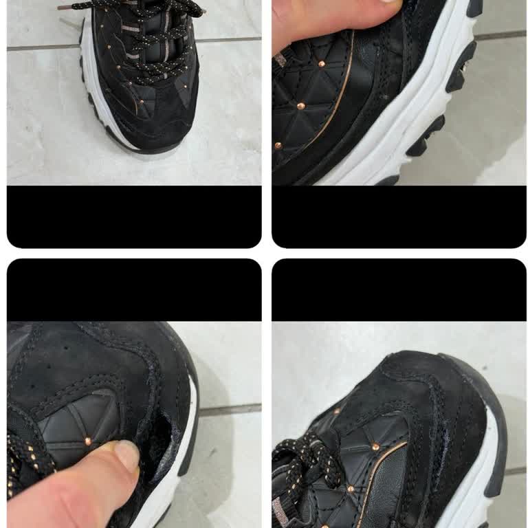 Skechers Ayakkabımda Dikiş Açılması Ve Kullanıcı Hatası İddiası Reddedildi