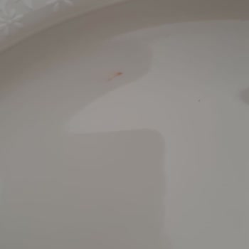 Korkmaz Mağazası Ayıplı Ürün, İade Şartı Ve Fatura Reddi