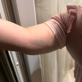 BİM Şubesinde Çocuk Yaralanması Ve Personelin Duyarsız Tutumu