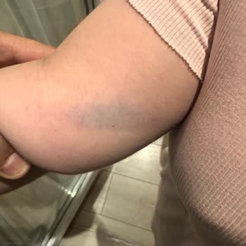 BİM Şubesinde Çocuk Yaralanması Ve Personelin Duyarsız Tutumu