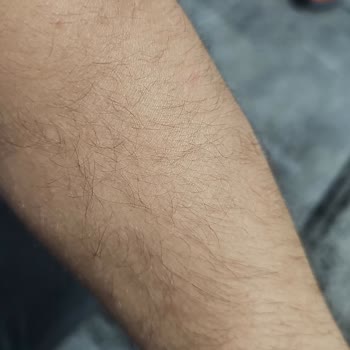 Mecidiyeköy Enza Şubesinde Epilasyon Paketi Sonuçsuz Ücret İadesi Talebi