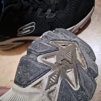 Skechers Ayakkabısında Kalite Sorunu Ve Erime Problemi