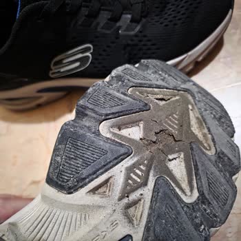 Skechers Ayakkabısında Kalite Sorunu Ve Erime Problemi
