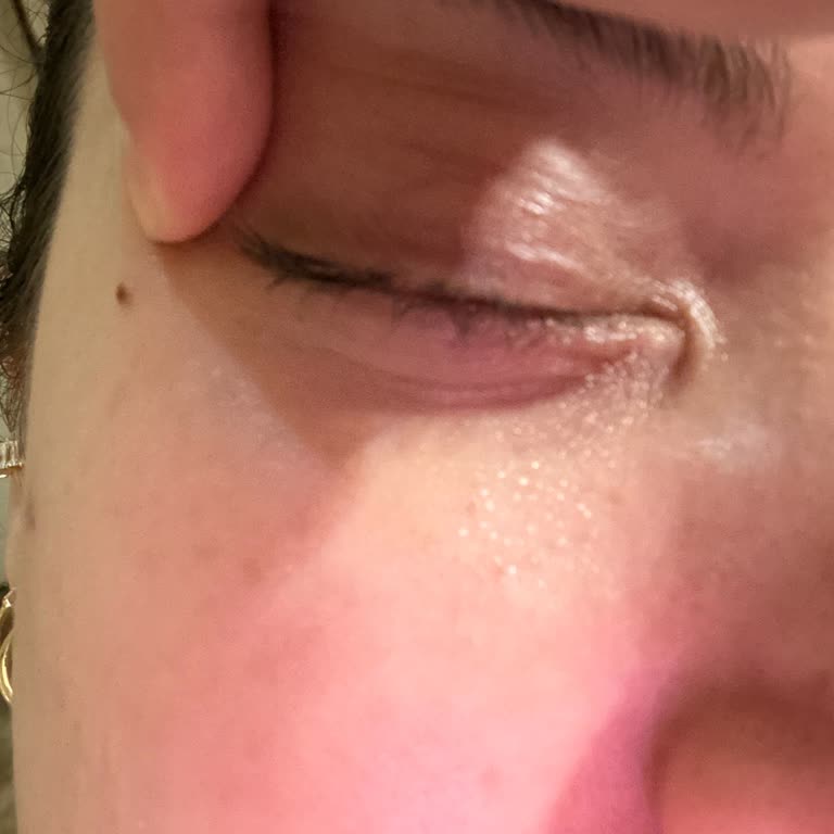 Estée Lauder Advanced Night Repair Göz Kremi Göz Çevresinde Şiddetli Kızarıklık Ve Şişlik Yarattı